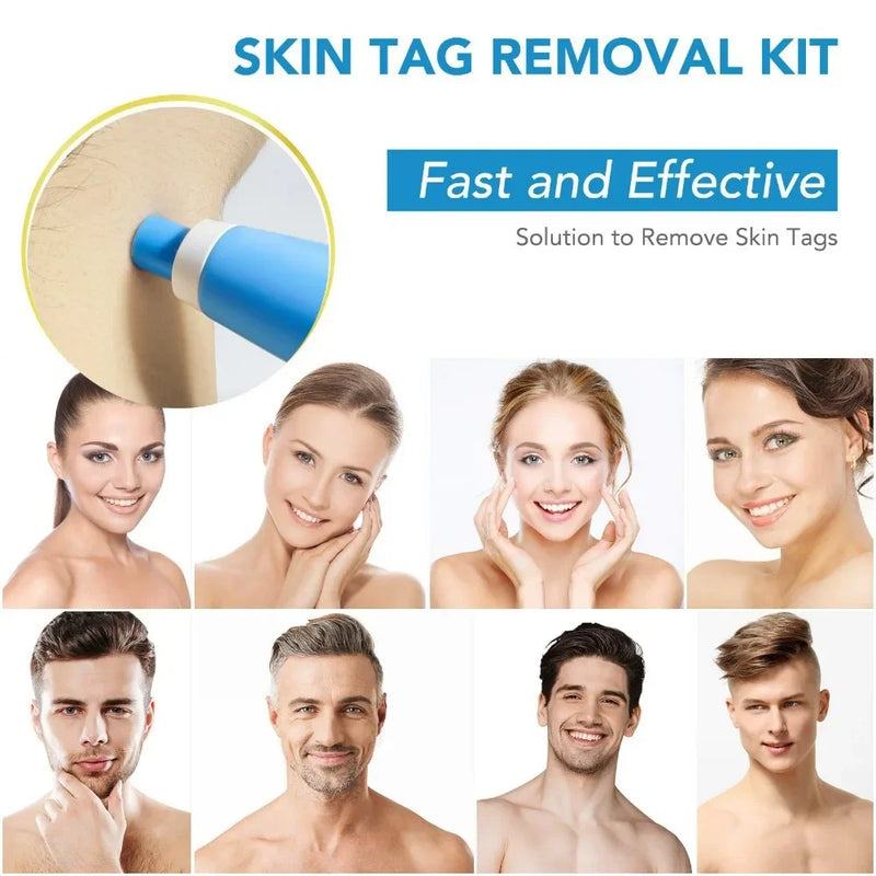 Painless Auto Skin Tag  Mole Removal Kit